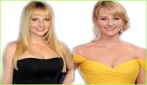 Melissa Rauch Plastic Surgery Before and After
